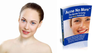 Read more about the article Acne No More Review