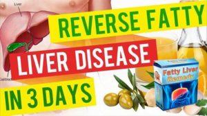 Read more about the article Fatty Liver Remedy Review