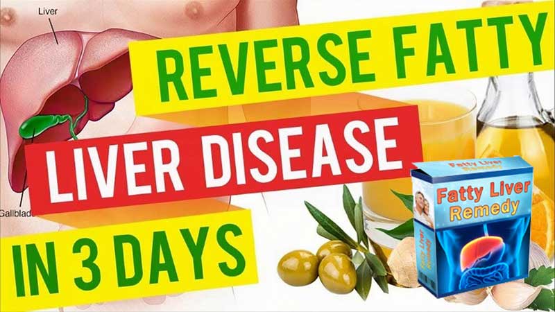 You are currently viewing Fatty Liver Remedy Review